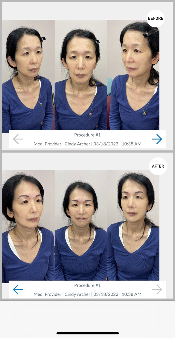 Permanent Eyebrows Before & After by Cindy Archer, C.A.A.M. at Permanently Beautiful in Missoula, Montana