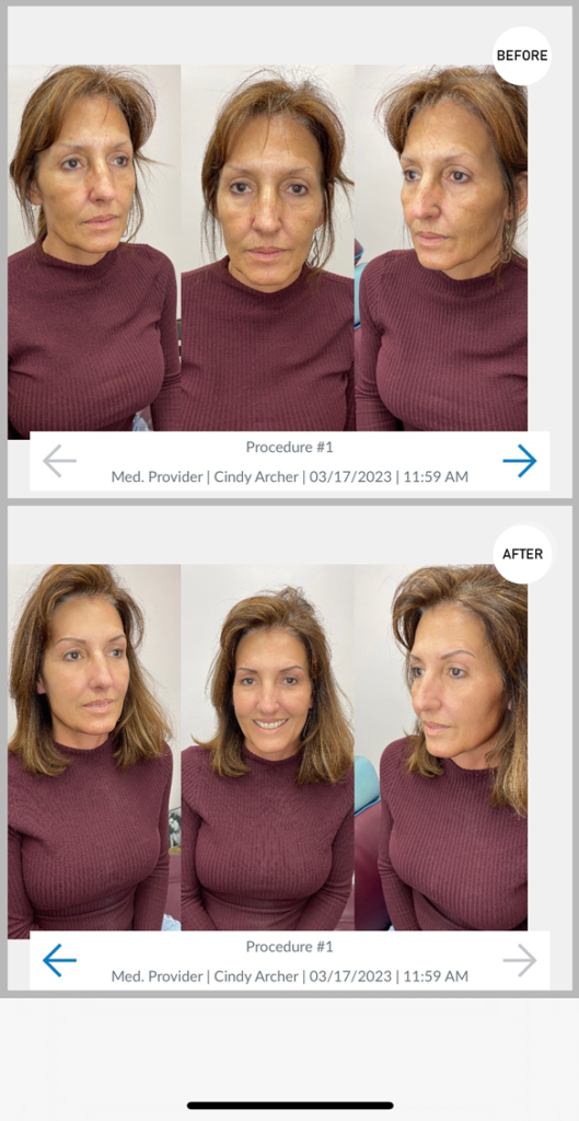 Permanent Eyebrows Before & After by Cindy Archer, C.A.A.M. at Permanently Beautiful LLC in Missoula, Montana