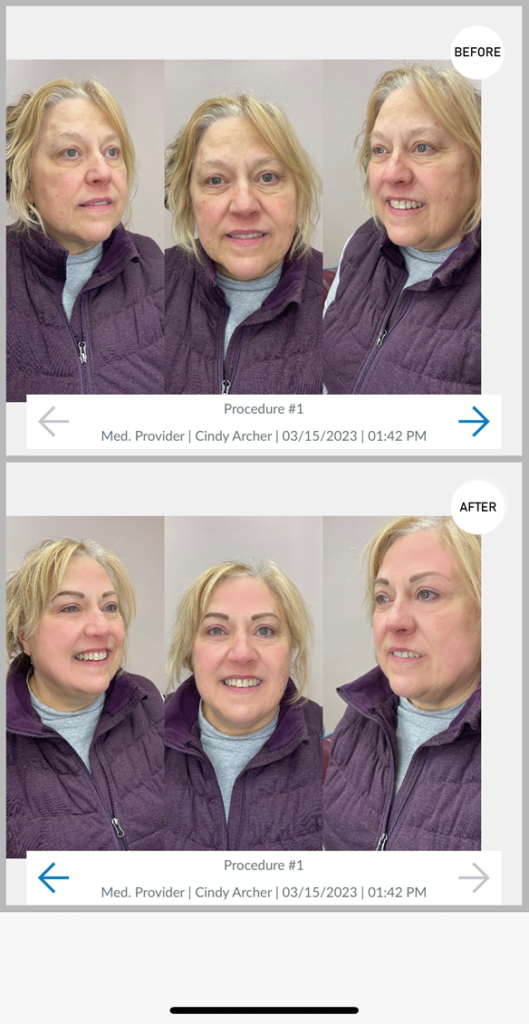 Permanent Eyebrows Before & After by Cindy Archer, C.A.A.M. at Permanently Beautiful LLC in Missoula, Montana