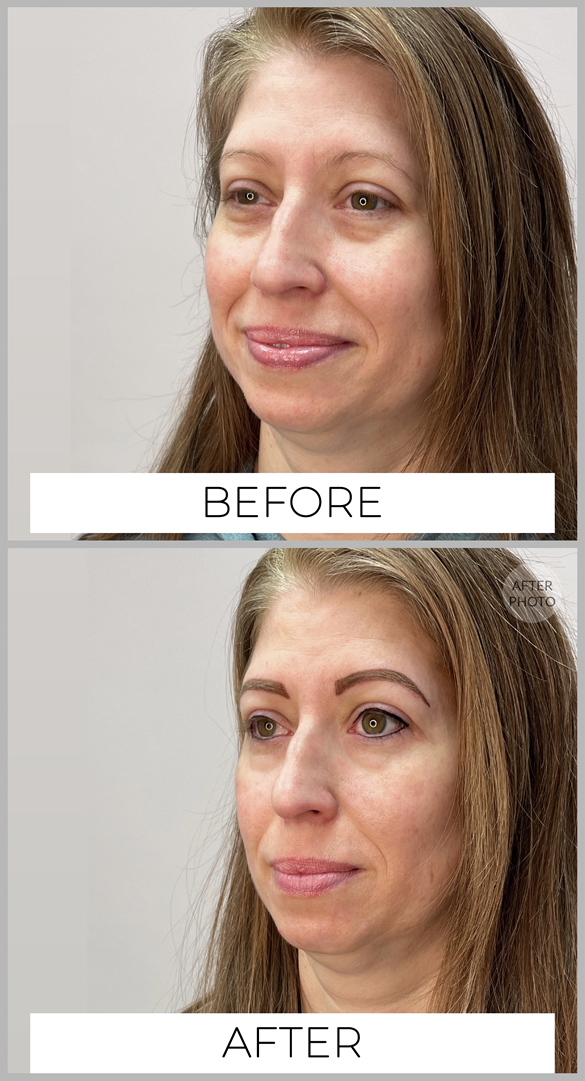 Permanent Eyebrows Before & After by Cindy Archer, C.A.A.M. at Permanently Beautiful in Missoula, Montana