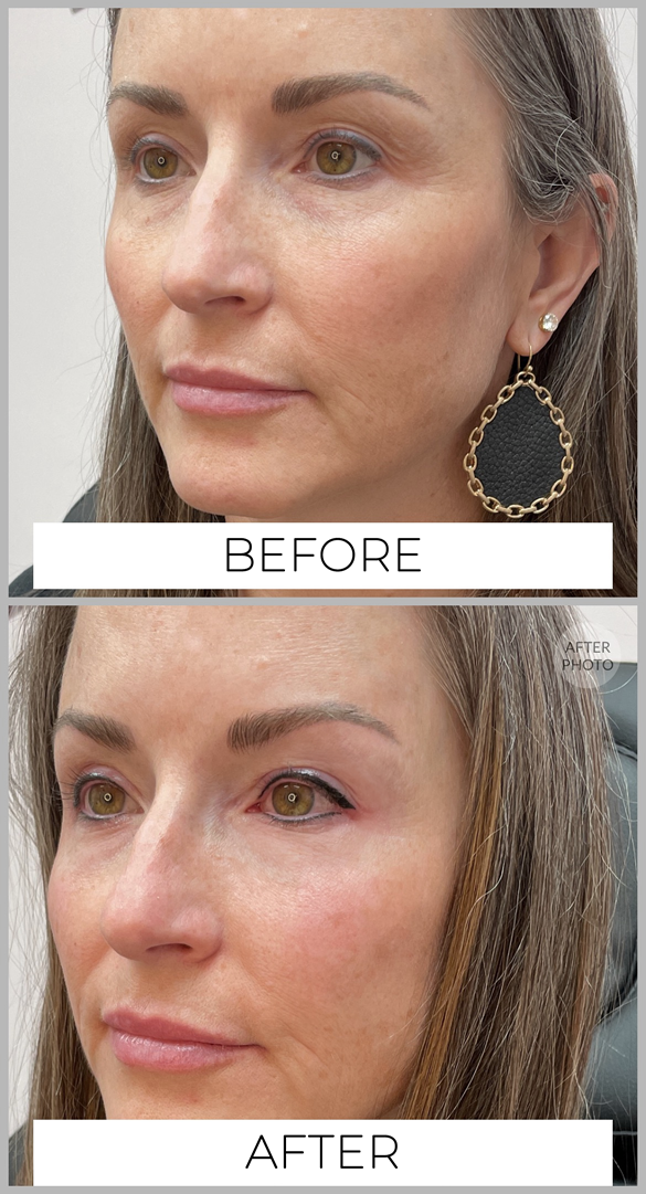 Permanent Eyebrows Before & After by Cindy Archer, C.A.A.M. at Permanently Beautiful in Missoula, Montana